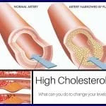 How to Raise Your Good Cholesterol